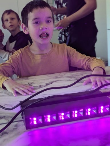 Ein Junge sitzt an einem Tisch, über ihm ein UV-Licht, während ein weiterer Junge im Hintergrund ist.